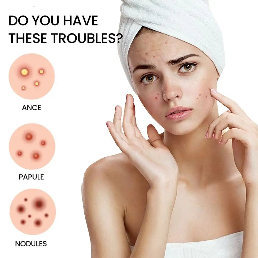 200pcs Star Pimple Patch Acne Invisible Acne Removal Stickers Originality Concealer Face Spot Beauty Skin Care Makeup Tools